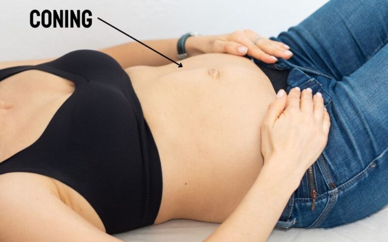 Coning During Pregnancy